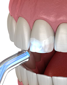 test-Conservative-dentistry