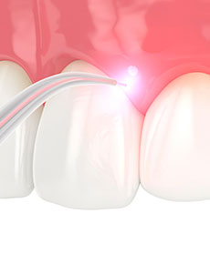 test-Surgical-laser