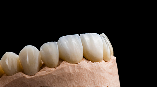 Dental-Crown-1